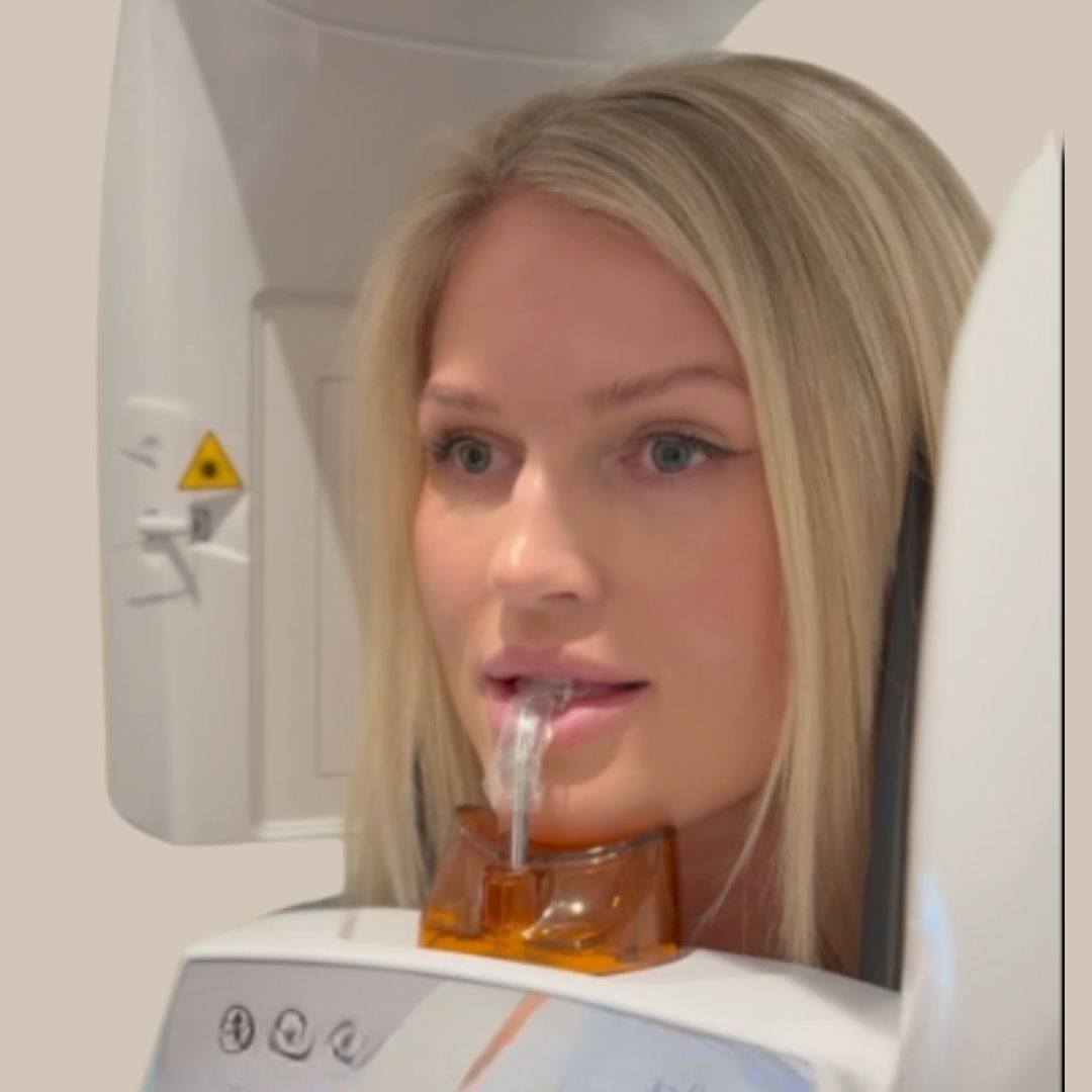 CBCT